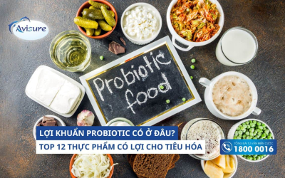 Lợi khuẩn probiotic có ở đâu? 12 thực phẩm tốt cho tiêu hóa